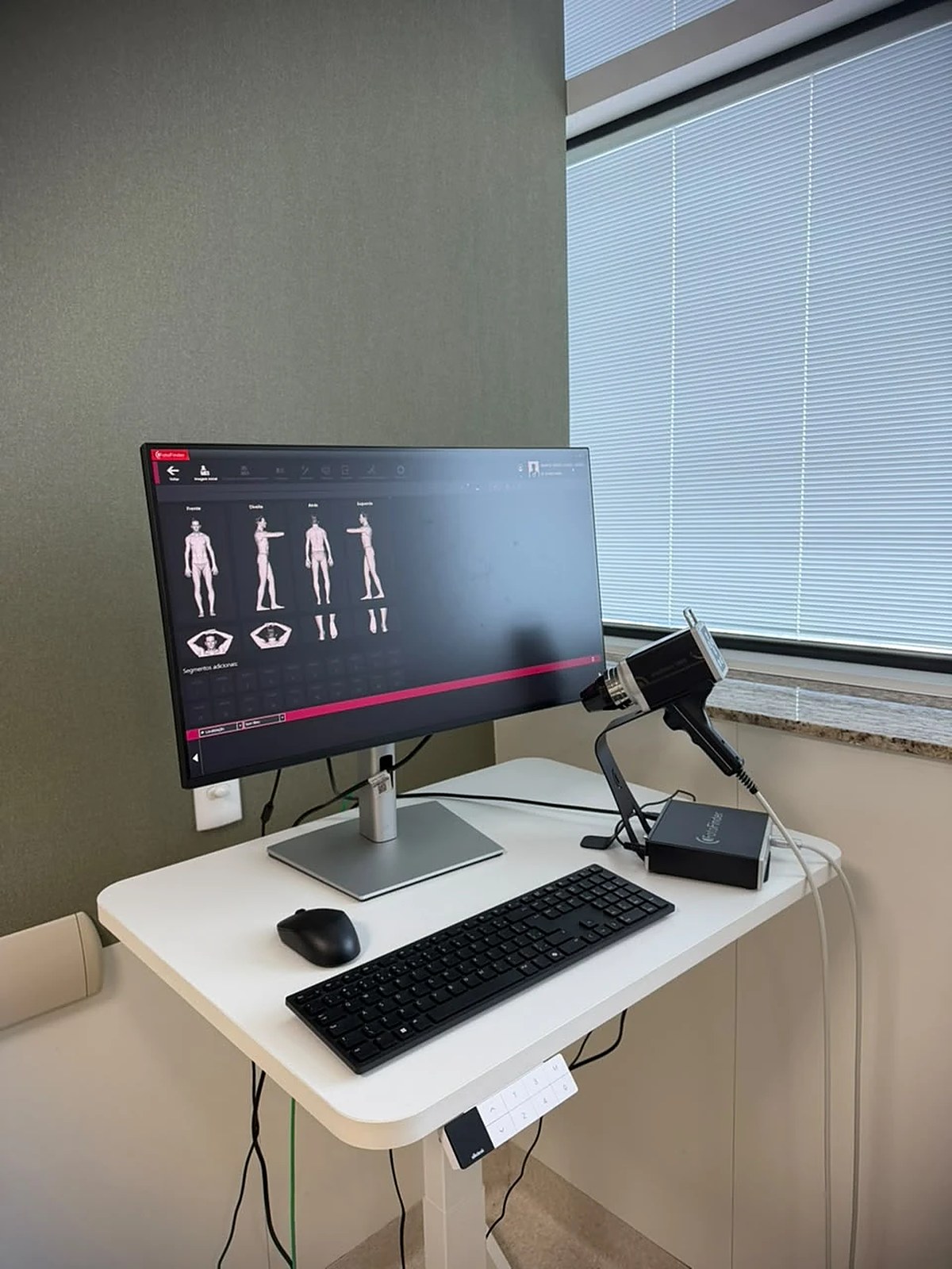 Sala de mapeamento corporal digital com o equipamento FotoFinder em Belo Horizonte